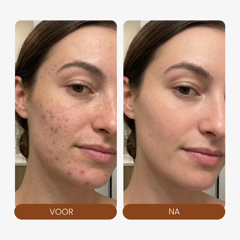 LED Face Mask + Halsmasker